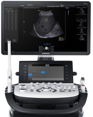 三星超声诊断HS60